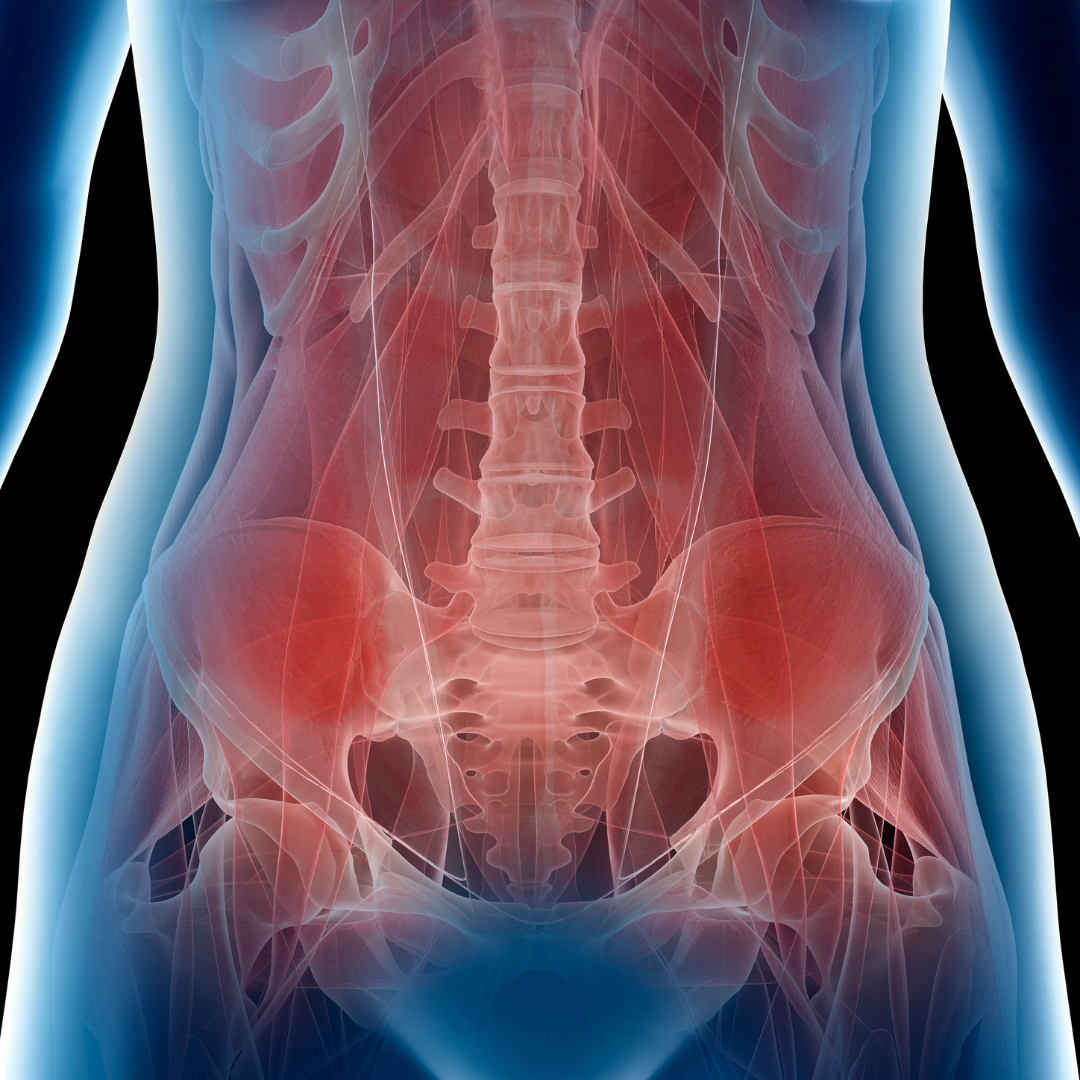 Diastasis of the Rectus Abdominis Muscles (RAD)
