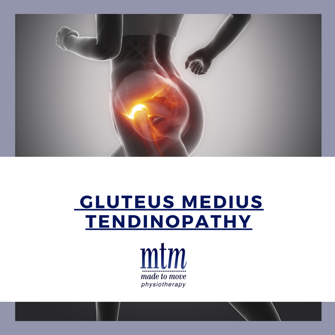 Greater Trochanteric Bursitis or Gluteus Medius Tendinitis